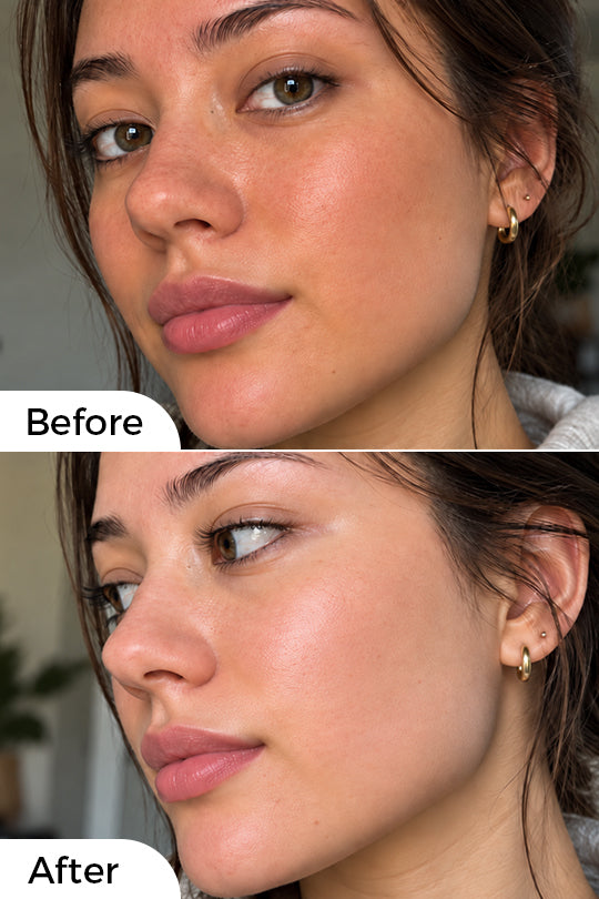 Before and after
